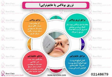 آر اف بهتر است یا هایفو